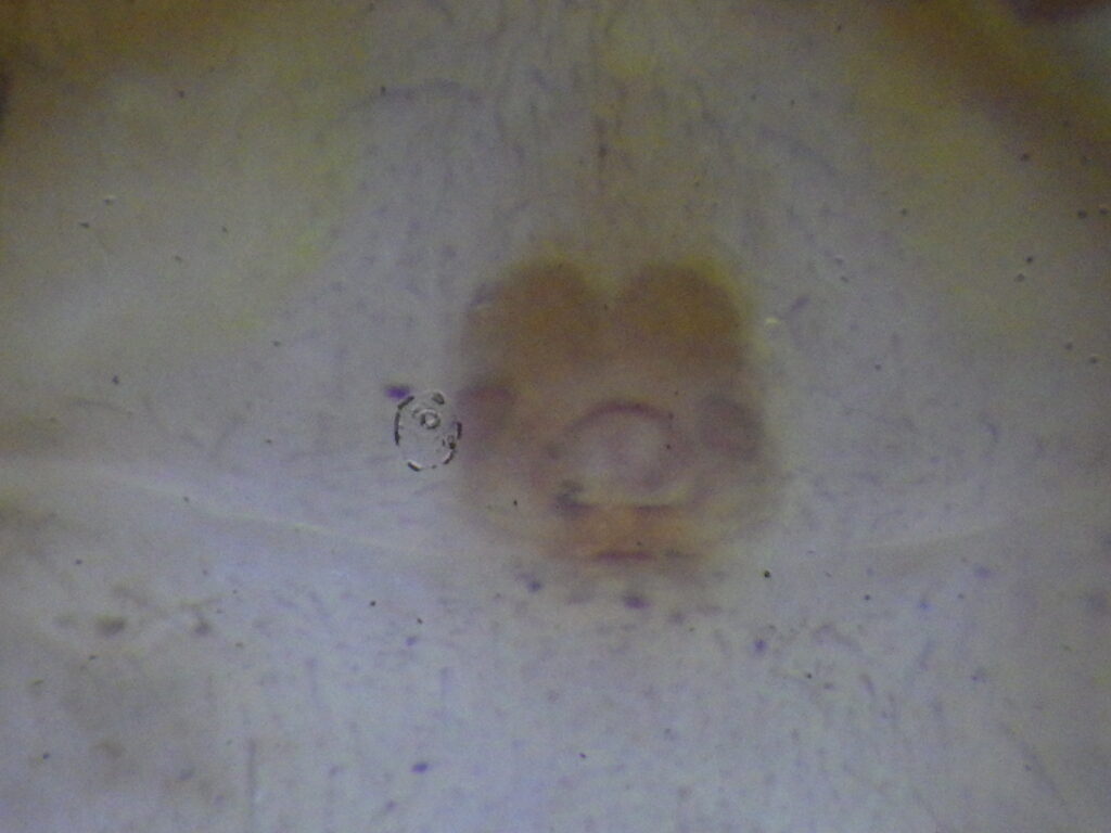 ヤサコマチグモ雌成体 Chiracanthium unicum の外雌器
