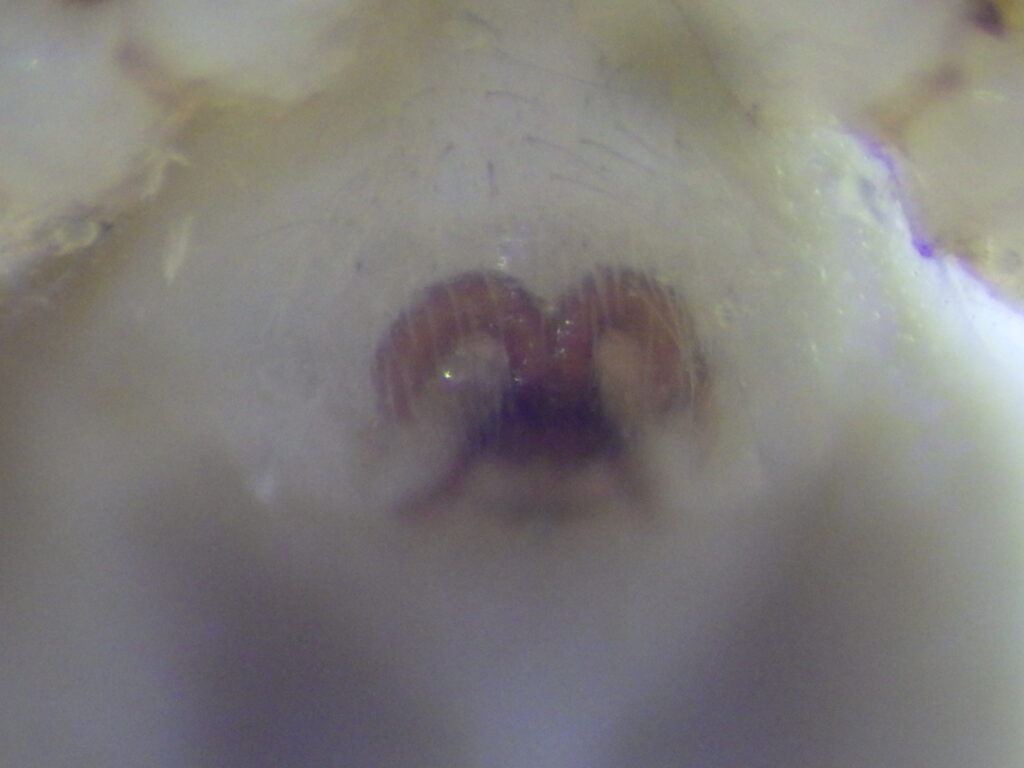 カギフクログモ雌成体 Chiracanthium unicum の外雌器